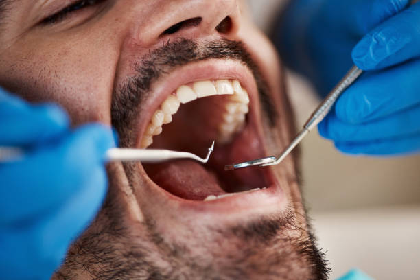 Best Emergency Treatment for Oral Infections in North Merritt Island, FL